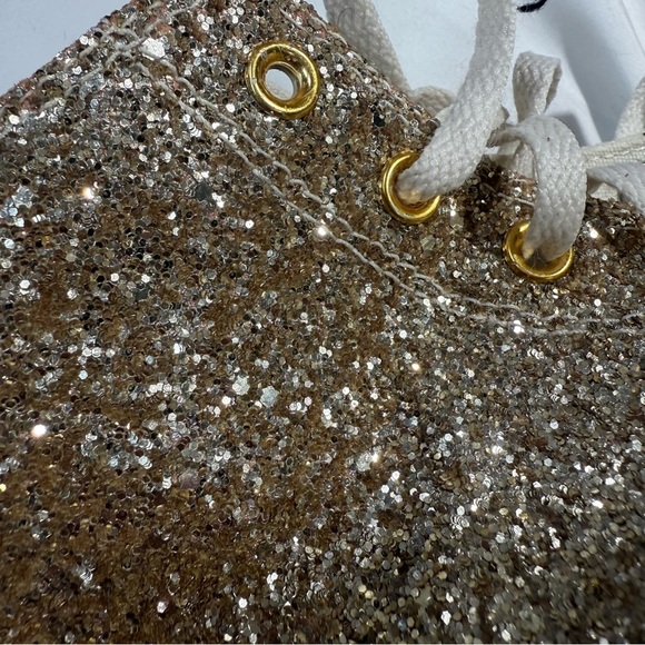 Custom Converse Zebra Stripe High-Top Sneakers With Gold Sparkles. 💖 - Picture 12 of 12